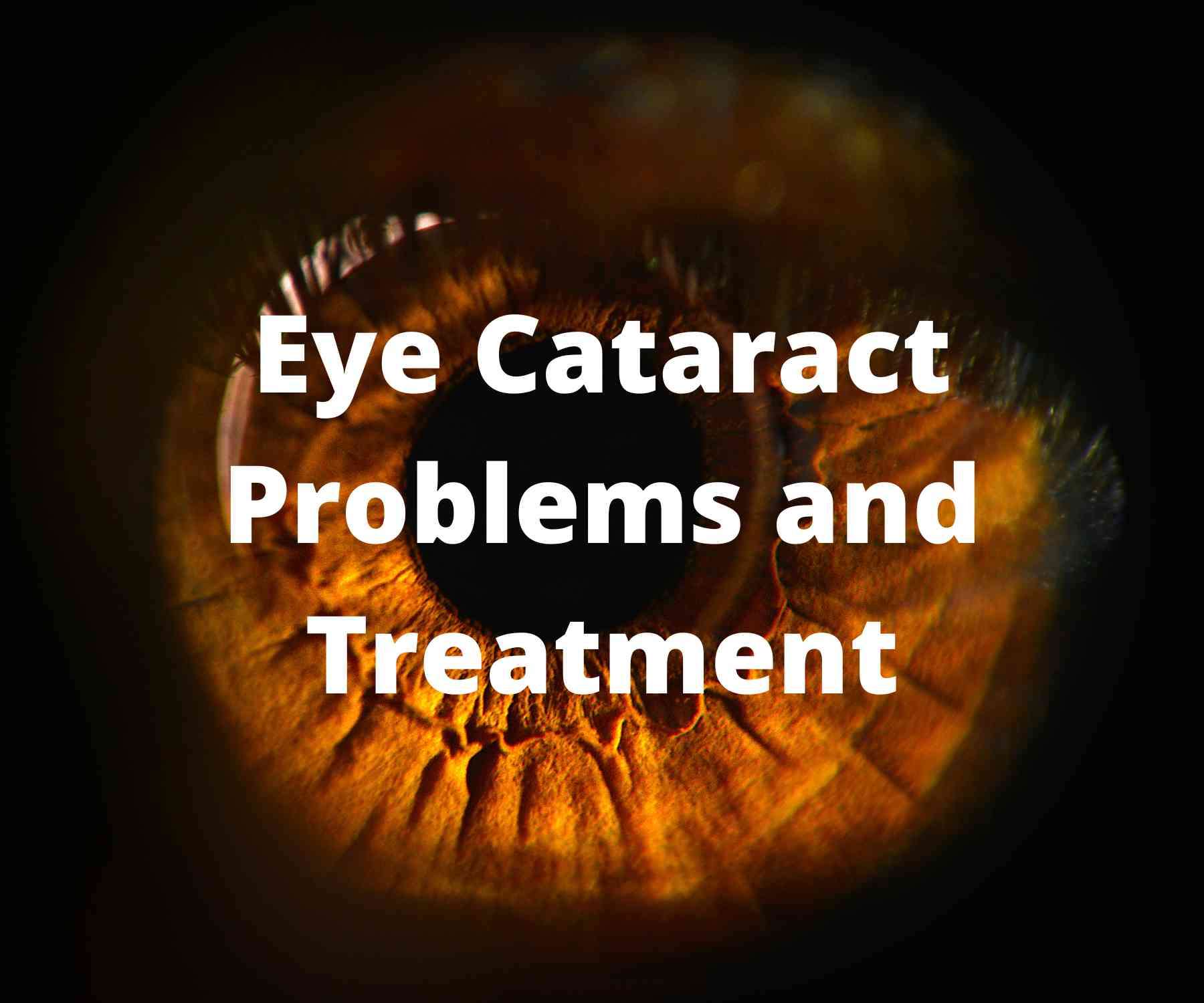 eye-cataract-problems-and-treatment