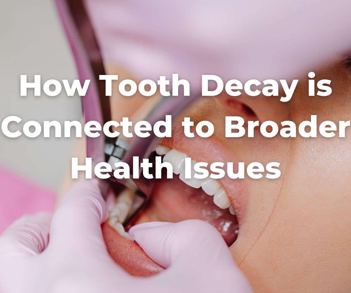 how-tooth-decay-is-connected-to-broader-health-issues